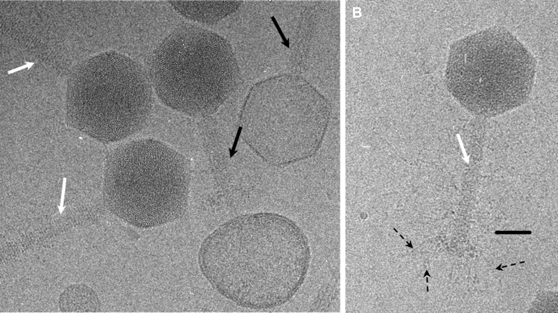 Cryo EM images of the φKZ virus (Fokine et al, Structure (2007))